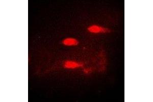 Immunofluorescent analysis of CALCOCO1 staining in A549 cells. (CALCOCO1 anticorps)