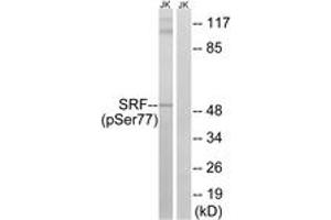 Western blot analysis of extracts from Jurkat cells treated with PMA 125ng/ml 30', using SRF (Phospho-Ser77) Antibody. (SRF anticorps  (pSer77))