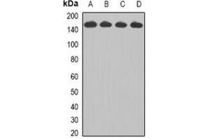 Western blot analysis of CCAR1 expression in Jurkat (A), HepG2 (B), A549 (C), A431 (D) whole cell lysates. (CCAR1 anticorps)