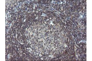 Image no. 6 for anti-Golgin, RAB6-Interacting (GORAB) (AA 35-394) antibody (ABIN1491441)