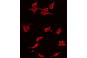 ABIN6275449 staining HeLa by IF/ICC. (RASSF6 anticorps  (Internal Region))