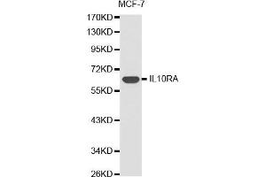 Western blot analysis of extracts of MCF-7 cell lines, using IL10RA antibody. (IL-10RA anticorps  (AA 22-230))