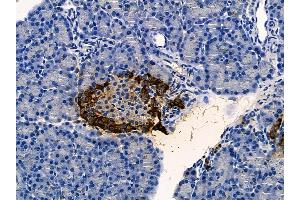 ABIN6257548 and ABIN6275544 at 1/100 staining rat pancreatic tissue by IHC-P. (VRK2 anticorps  (Internal Region))