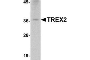 Western blot analysis of TREX2 in rat liver tissue lysate with this product at 2. (TREX2 anticorps  (C-Term))