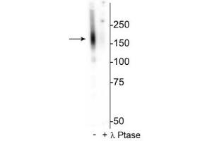 Western blot of mouse kidney lysate showing specific immunolabeling of the ~160 kDa NCC protein phosphorylated at Thr53 in the first lane (-). (SLC12A3 anticorps  (pThr53))