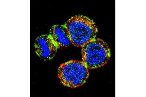 Confocal immunofluorescent analysis of BIRC3 Antibody (N-term) (ABIN657941 and ABIN2846885) with MDA-M cell followed by Alexa Fluor 488-conjugated goat anti-rabbit lgG (green).