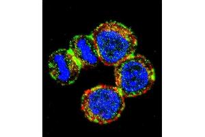 Confocal immunofluorescent analysis of BIRC3 Antibody (N-term) (ABIN657941 and ABIN2846885) with MDA-M cell followed by Alexa Fluor 488-conjugated goat anti-rabbit lgG (green). (BIRC3 anticorps  (N-Term))