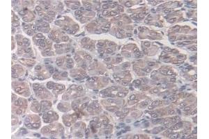 Detection of NAT1 in Mouse Stomach Tissue using Polyclonal Antibody to N-Acetyltransferase 1 (NAT1)