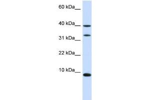 WB Suggested Anti-DBI Antibody Titration:  0.