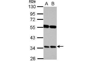 WB Image Sample (30 ug of whole cell lysate) A: Raji B: K562 10% SDS PAGE antibody diluted at 1:1000 (RASSF7 anticorps  (Center))