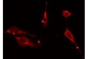 ABIN6276614 staining HuvEc cells by IF/ICC. (ARHGDIA anticorps  (N-Term))