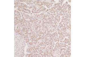 Immunohistochemistry (IHC) image for anti-POU Domain, Class 2, Transcription Factor 1 (POU2F1) (AA 250-300) antibody (ABIN7453473)