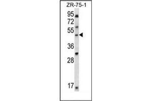 Western blot analysis of LDB1 Antibody (C-term) in ZR-75-1 cell line lysates (35ug/lane). (LIM Domain Binding 1 Protein anticorps  (C-Term))