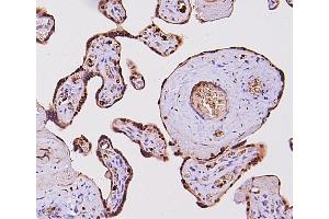 IHC analysis of FOSB using anti-FOSB antibody (ABIN3042399).