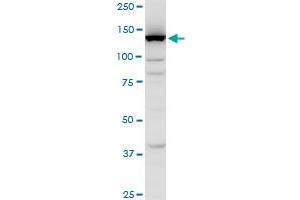 FLJ39155 polyclonal antibody (A01), Lot # 051024JC01. (EGFLAM anticorps  (AA 914-1001))