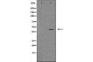 Western blot analysis of Hela whole cell lysates, using HSD3B2 Antibody. (HSD3B2 anticorps)