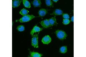 IF analysis of Caldesmon using anti-Caldesmon antibody (ABIN4886498). (Caldesmon anticorps  (AA 1-120))