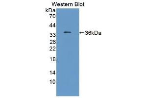 Detection of Recombinant TKT, Human using Polyclonal Antibody to Transketolase (TKT) (TKT anticorps  (AA 1-294))