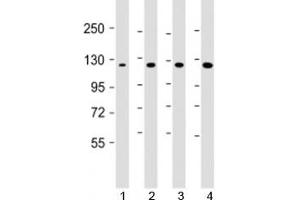 Western blot testing of 1) human DU-145, 2) human HepG2, 3) mouse brain and 4) HeLa cell lysate with AIP1 antibody at 1:1000. (DAB2IP anticorps  (AA 782-1038))