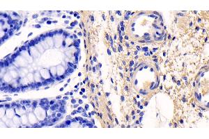 Detection of COL1a1 in Human Colon Tissue using Monoclonal Antibody to Collagen Type I Alpha 1 (COL1a1)