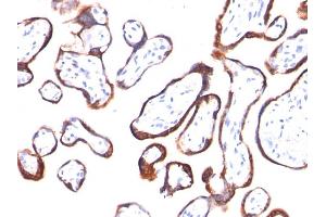 Formalin-fixed, paraffin-embedded human Placenta stained with hCG beta Mouse Monoclonal Antibody (HCGb/54). (CGB anticorps)