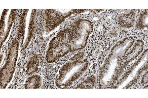IHC analysis of Ku70 using anti-Ku70 antibody (ABIN7602791).