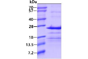 SDS-PAGE (SDS) image for Chromosome 17 Open Reading Frame 49 (C17orf49) (AA 1-172) protein (His tag) (ABIN1098372)