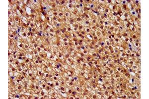 IHC image of ABIN7146392 diluted at 1:400 and staining in paraffin-embedded human adrenal gland tissue performed on a Leica BondTM system.