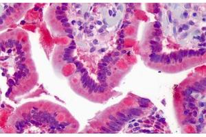 Human Small Intestine: Formalin-Fixed, Paraffin-Embedded (FFPE)