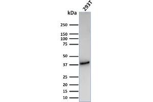 Western Blot Analysis of Human 293T cell lysate using CD74 Recombinant Rabbit Monoclonal Antibody (CLIP/3127R). (Recombinant CD74 anticorps)