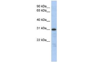 WB Suggested Anti-HOXD9 Antibody Titration:  0. (HOXD9 anticorps  (Middle Region))