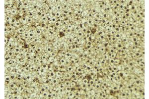 ABIN6273350 at 1/100 staining Mouse liver tissue by IHC-P.