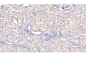 Detection of GUCY1b3 in Human Kidney Tissue using Polyclonal Antibody to Guanylate Cyclase 1 Beta 3 (GUCY1b3)
