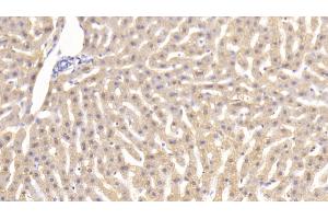 Detection of TNFa in Rabbit Liver Tissue using Monoclonal Antibody to Tumor Necrosis Factor Alpha (TNFa) (TNF alpha anticorps  (AA 80-235))