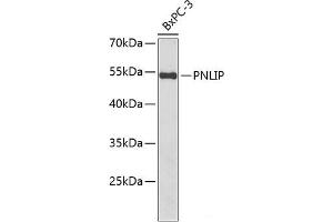 Western blot analysis of extracts of BxPC-3 cells using PNLIP Polyclonal Antibody at dilution of 1:1000. (PNLIP anticorps)