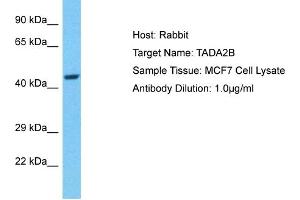 Host: Rabbit Target Name: TADA2B Sample Type: MCF7 Whole Cell lysates Antibody Dilution: 1.