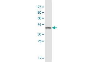 Western Blot detection against Immunogen (37.