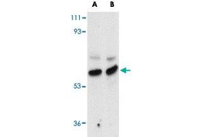 Western blot analysis of MATN3 in rat thymus tissue lysate with MATN3 polyclonal antibody  at (A) 1 and (B) 2 ug/mL . (Matrilin 3 anticorps  (Internal Region))