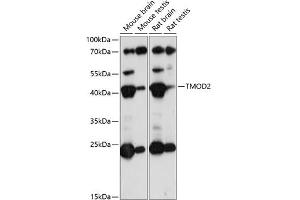 Western blot analysis of extracts of various cell lines, using TMOD2 antibody (ABIN7271012) at 1:1000 dilution.