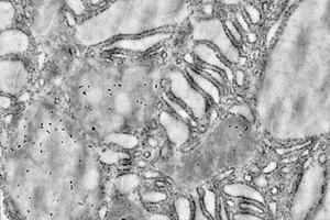 Immunoelectron microscopy analysis of LR white resin-embedded mouse pancreas using HSP60 (ABIN7074167) at dilution of 1: 50.