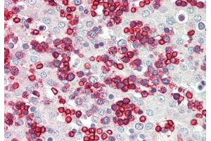 Rabbit Anti-ERMAP antibody  Formalin Fixed Paraffin Embedded Tissue: Human Fetal Liver Primary antibody Concentration: 1:100 Secondary Antibody: Donkey anti-Rabbit-Cy3 Secondary Antibody Concentration: 1:200 Magnification: 20x Exposure Time: 0.