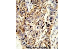 Immunohistochemistry (IHC) image for anti-Fibulin 3 (FBLN3) antibody (ABIN3004030)