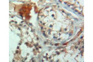 IHC-P analysis of testis tissue, with DAB staining. (CRAT anticorps  (AA 363-626))