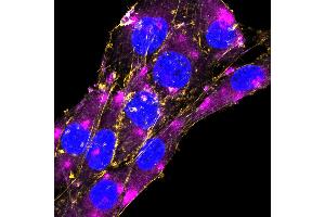 Expression of GFAP in rat C6 glioma cellsFixed and permeabilized cells were stained with Anti-GFAP-ATTO Fluor-647N Antibody (ABIN7582030), (1:200) and with CellMask Orange Actin tracking dye (yellow). (GFAP anticorps  (Intracellular) (Atto 647N))