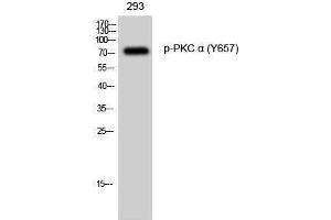 Western Blotting (WB) image for anti-Protein Kinase C, alpha (PKCa) (pTyr657) antibody (ABIN3182236) (PKC alpha anticorps  (pTyr657))