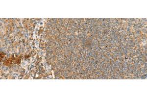 Immunohistochemistry of paraffin-embedded Human tonsil tissue using CD48 Polyclonal Antibody at dilution of 1:95(x200)