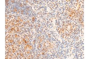 ABIN6267237 at 1/100 staining mouse spleen tissue sections by IHC-P.