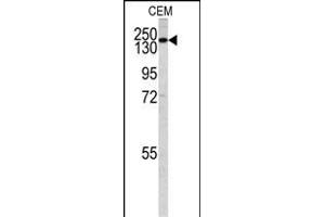 Western blot analysis of PI3KC2G antibody (N-term) (ABIN392551 and ABIN2842099) in CEM cell line lysates (35 μg/lane).