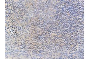 ABIN6258276 and ABIN6274540 at 1/100 staining human normal tonsil tissue by IHC-P.