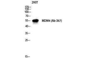 Western Blotting (WB) image for anti-Mdm4-binding Protein (MDM4) (Ser885) antibody (ABIN3175952) (MDM4-binding Protein anticorps  (Ser885))